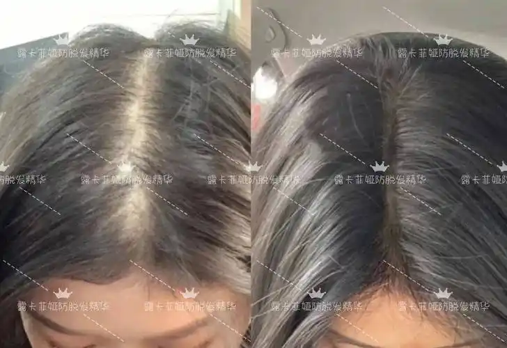 公认防脱发最好的洗发水是什么防脱生发好物分享