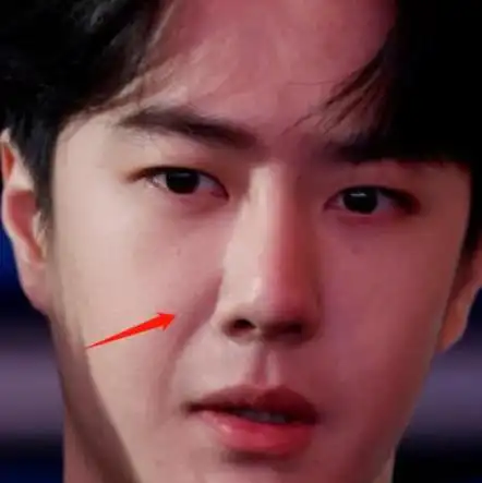 许多男明星为了增加吸引力,在出道前或者出道后进行了整容.