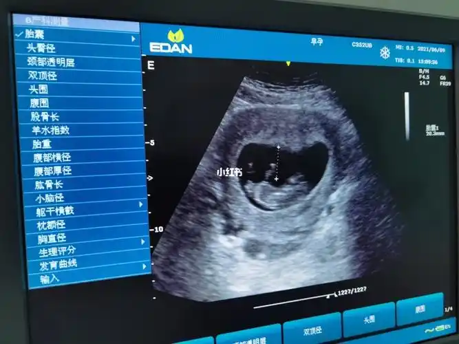 孕11周,感冒了,做b超发育挺好