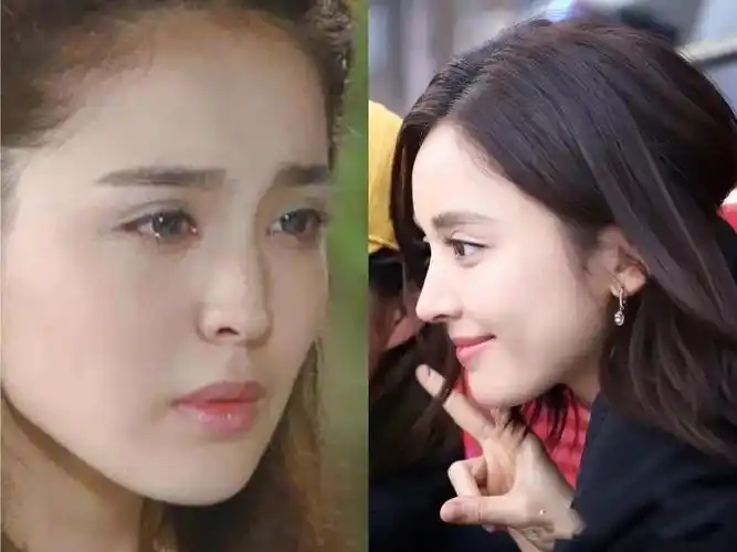 1鼻子 娜扎的鼻子是典型的驼峰鼻,鼻