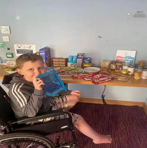 麻省理工学院开发新的截肢程序,让患者对假肢有更好的"感觉"