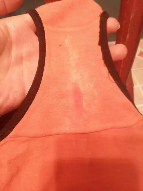 月经后几天感觉白带有点多,麻烦医生帮忙看下,谢谢了