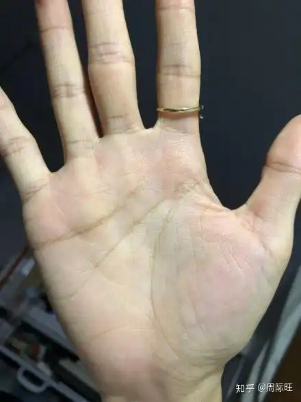 案例简单解析二十二 - 知乎