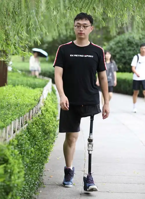 髋关节离断假肢的发展