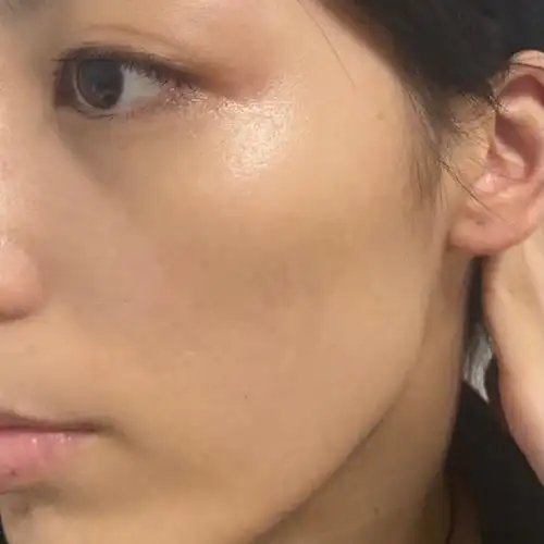 粗糙暗沉暗哑面部暗沉粗糙图片肤色暗沉不均匀图片皮肤暗沉面部暗沉