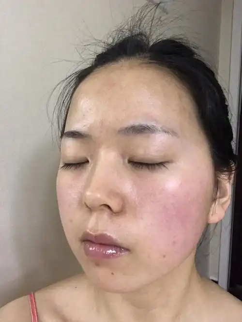 敏感肌7天修复有图有真相_海蓝之谜精华怎么样_海蓝之谜面霜怎么样_小