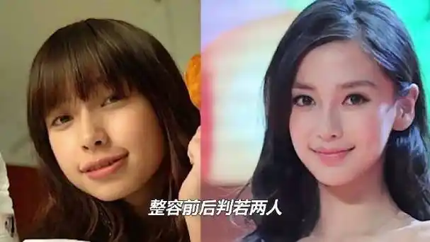 整容前后判若两人,鞠婧祎拒不承认,杨颖只做了牙齿