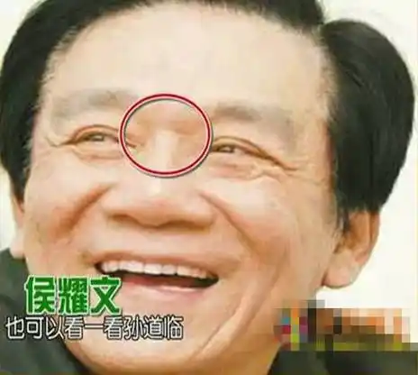 警惕脸上几种皱纹暗示你有病了高鼻梁真能捏出来奇葩说法是真是假