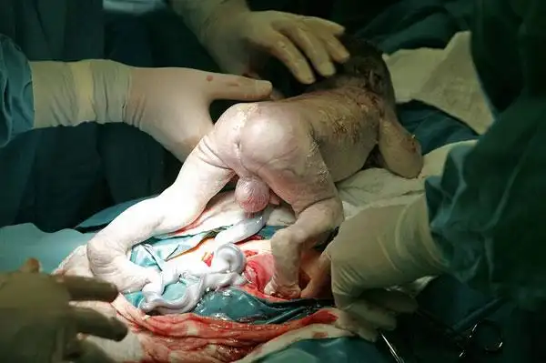 女人,生育,产房