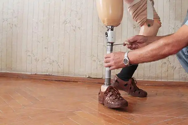 科研动态德国研究人员开发低成本3d打印假肢来帮助难民