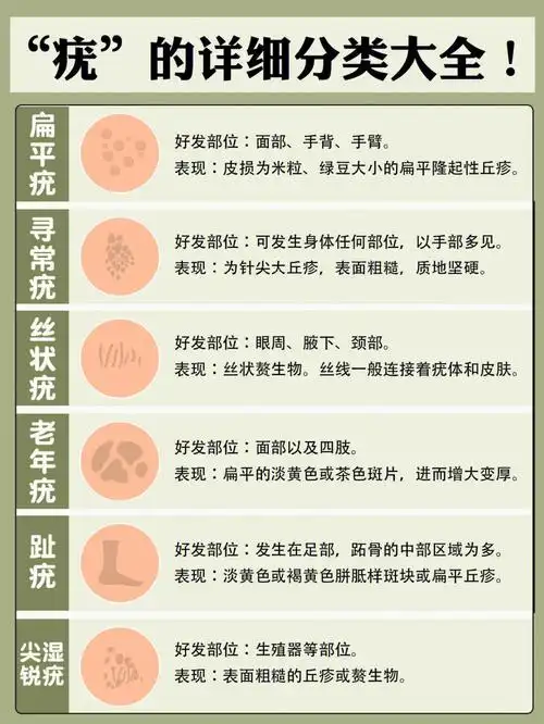全面总结疣的分类以及护理措施75