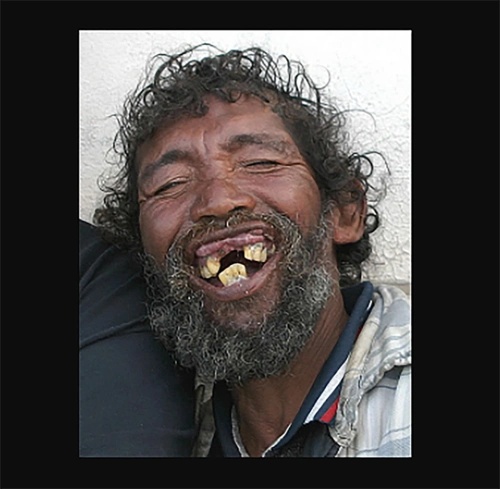 世界上最丑的人