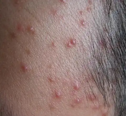 "我是感染艾滋病了吗?