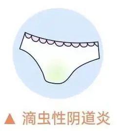 3,滴虫性阴道炎:颜色呈黄绿色,性状为泡沫状,伴有臭味,外阴会有瘙痒的