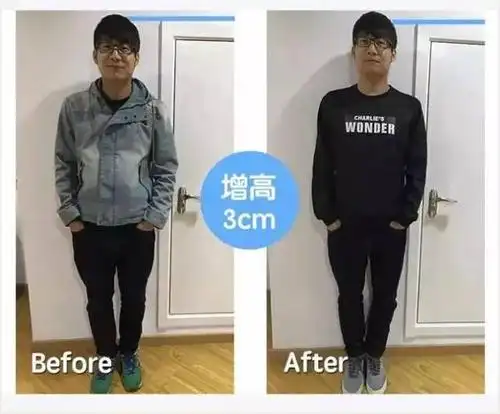 27岁的他从177cm增高到182cm只因做了这件事