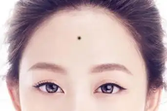 额头中间的地方是事业宫,假如在这里长痣,一般表示他的事业发展进程会