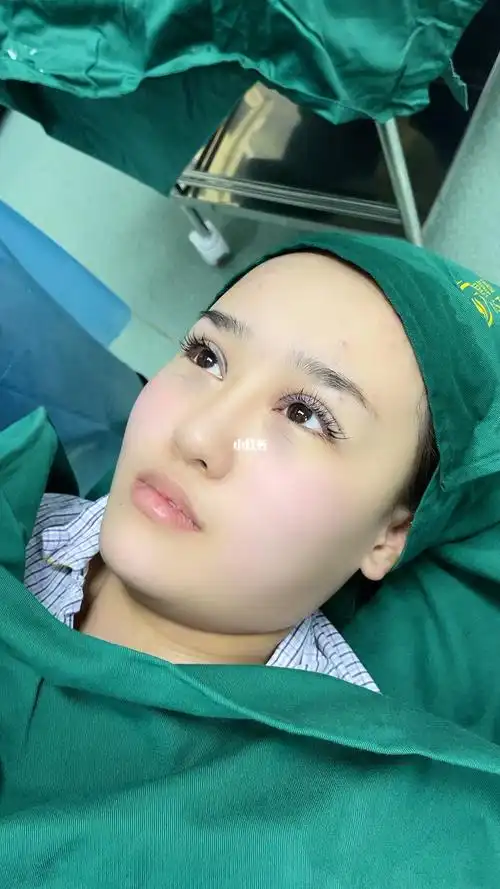 双眼皮术后即刻效果_双眼皮_割双眼皮_美妆_医美整形