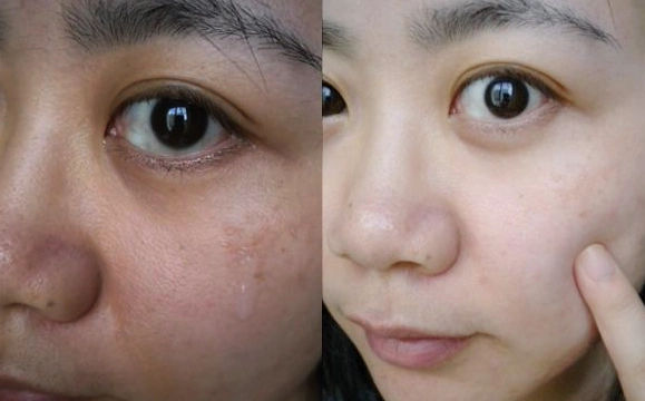 岁月催人老,到了一定年龄皮肤都会衰老的,再加上平