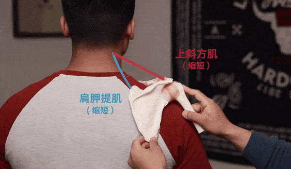 3种上斜方肌拉伸策略