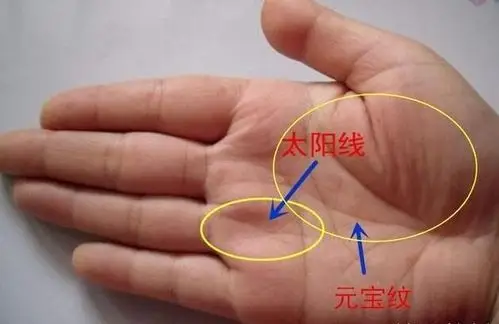 太阳线属于较为难得的纹线,最喜深细而秀长,和其他主线配合得体,容易