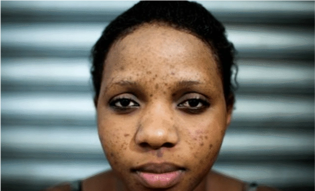 原创 笑谈历史啊 4天前 我要分享 在世界三大人种当中,黑人的人口