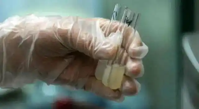 男人每次排精量多少正常?健康的精液是什么颜色?