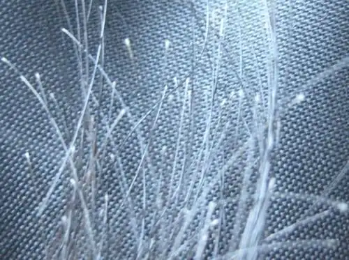 女生掉头发多,发根有小白点是毛囊吗