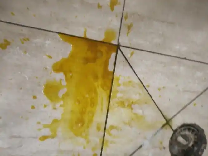 图片慎点这是吐出来的胆汁吗