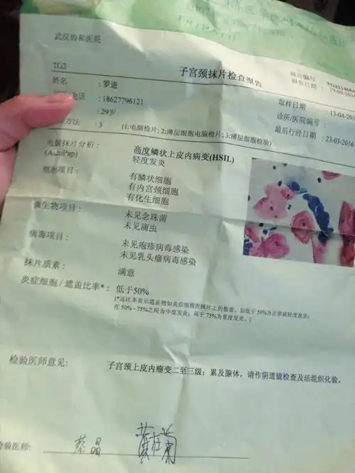 做刷片可不可以直接查出是宫颈癌的结果