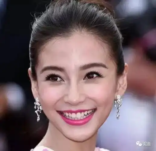 818那些整过牙的女明星