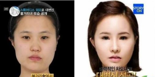 综合起来, 突兀的骨相和不够柔美的五官是大部分韩国人的原生形象,让