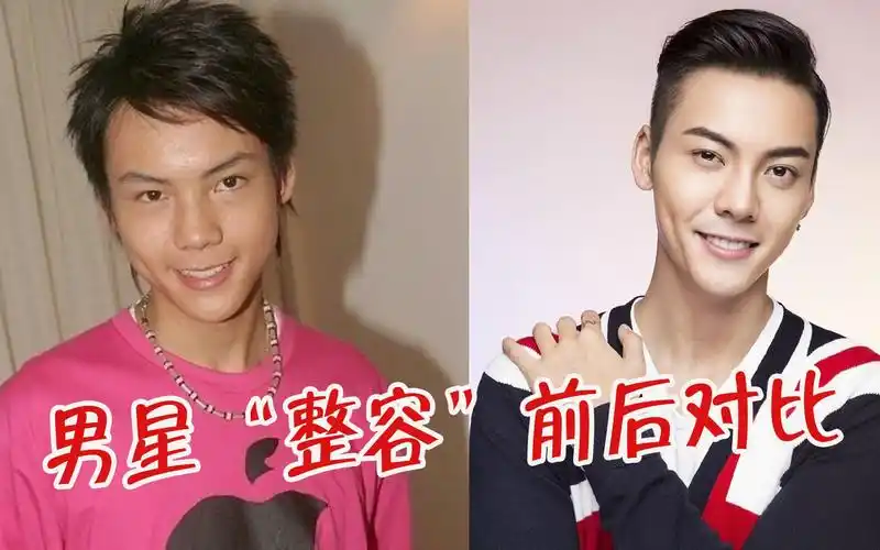 男星"整容"前后对比,黄晓明蜕变男神,陈伟霆刘恺威堪称换脸