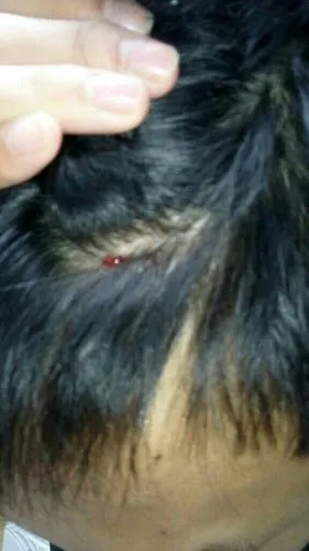 头被抽油烟机撞了,出血了,有没有问题,需要怎么处理