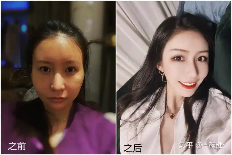 整容对一个人的变化有多大? - 知乎