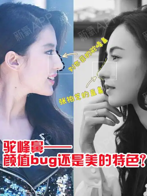 驼峰鼻颜值bug还是美的特色