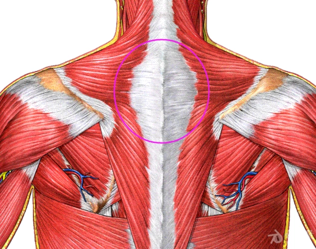 分享一典型斜方肌损伤病例