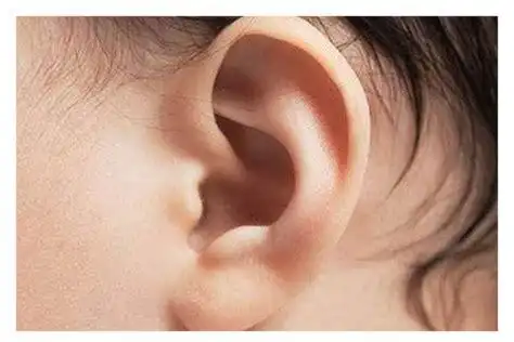 耳朵小的人没福气吗耳垂小耳朵薄没福气2022已更新今日热点