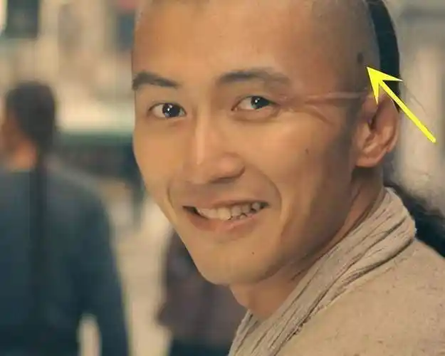 张恒远的绝症孙红雷13年前演过谢霆锋剃光头躲过一劫