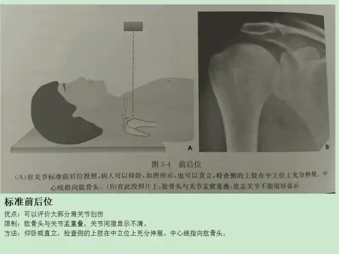 不同肩关节x线投照位ppt课件