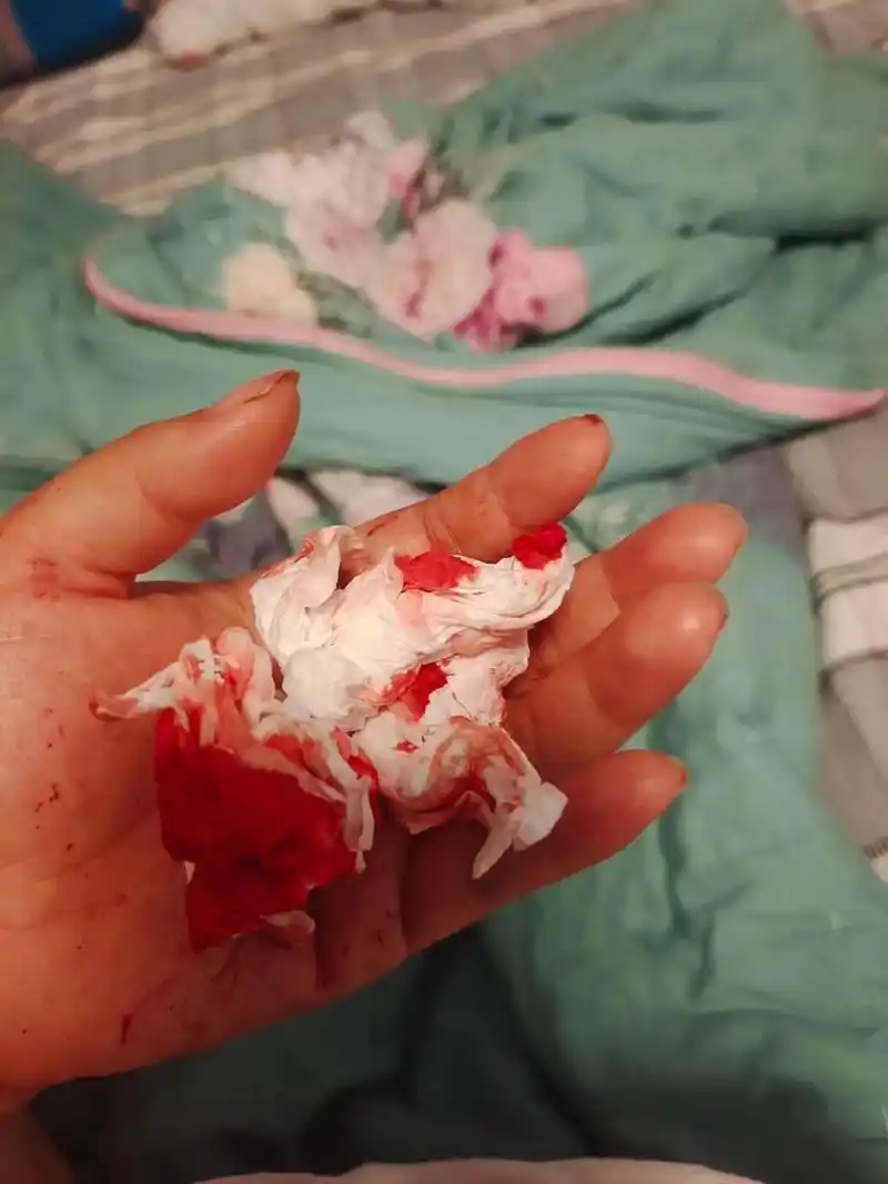 看到我手上的血 你说:妈妈,别把手弄脏了 我对你说:没关系