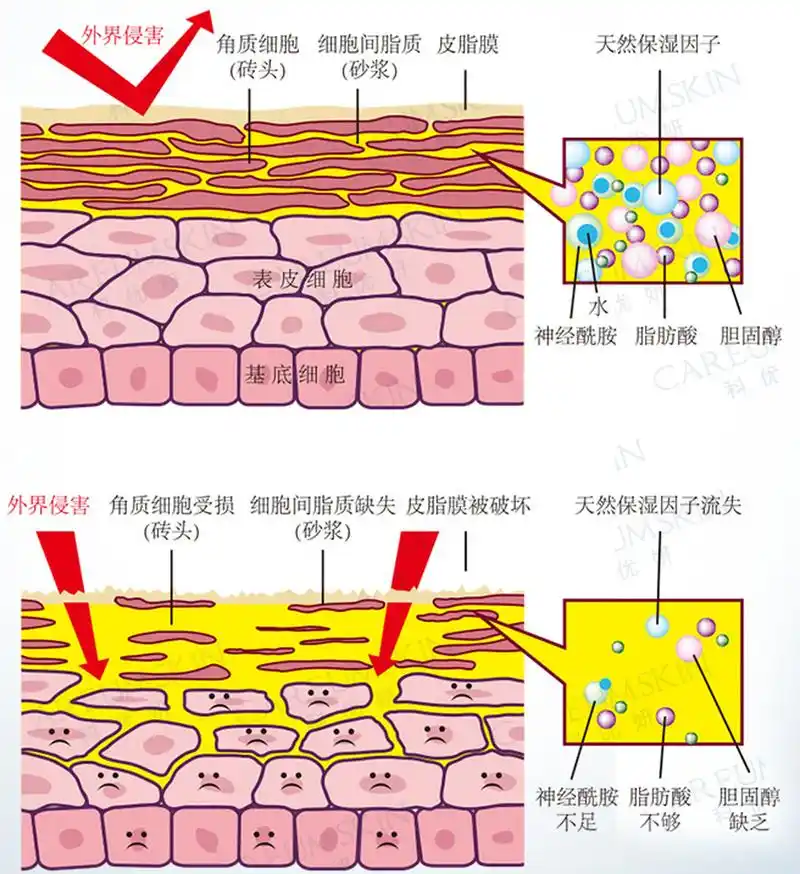 人体皮肤角质层的结构是"砖泥结构".