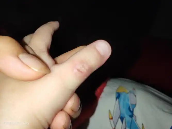 14个月25天的宝宝吃手手成这样了怎么办