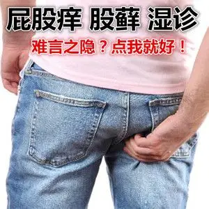 止痒药膏私处成人阴囊潮湿湿疹膏肛门瘙痒股癣膏外阴瘙痒屁股痒