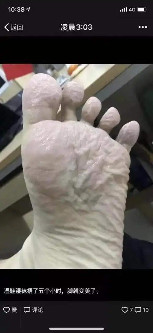 基层民警的一夜日常从一个被泡发了的脚底说起