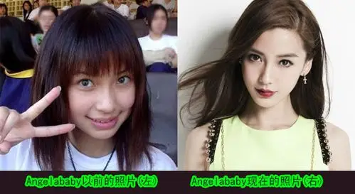 baby整容前后照片