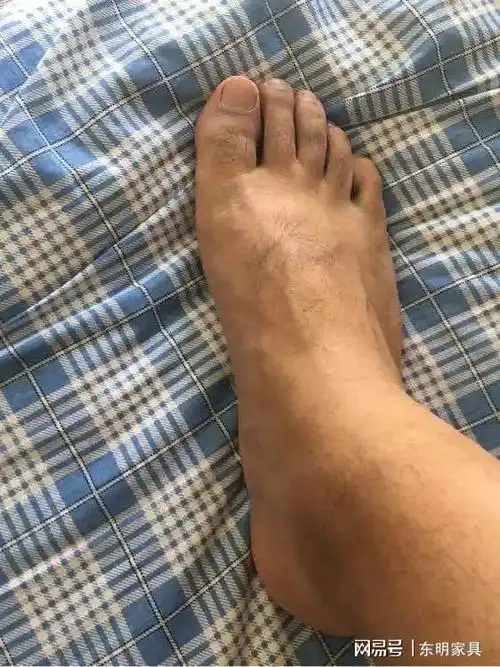 身上这几个地方毛发旺盛别拔了代表财运旺身体棒