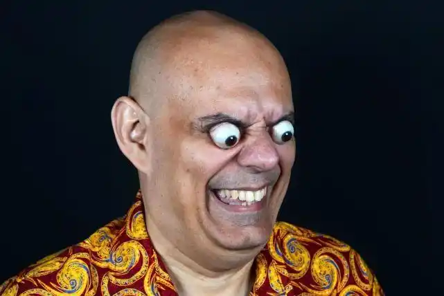 眼睛瞪得像铜铃世界上眼球最突出的人