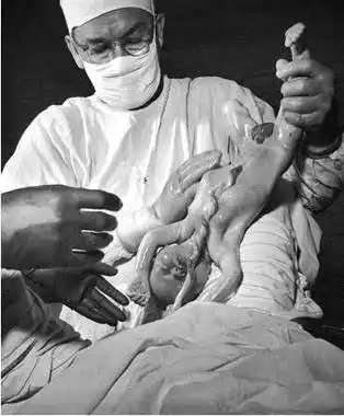 你所未知的胎儿和孕妇照