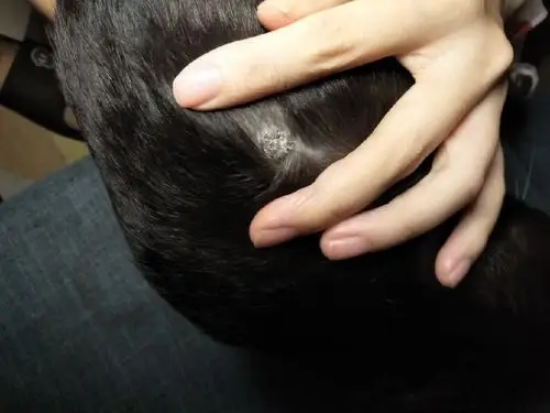 医生,我家大黑得了什么病