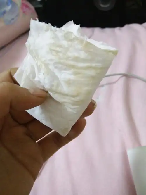 孕40周流出一点白色分泌物